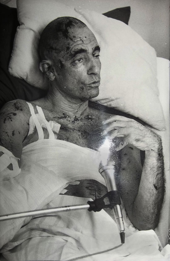 Albie interviewed in hospital after the bomb.
